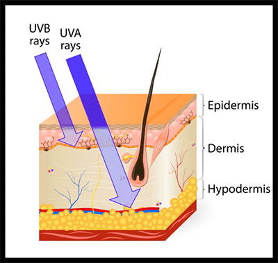 uva-vs-uvb-rays_400px-min uva-vs-uvb-rays_400px-min