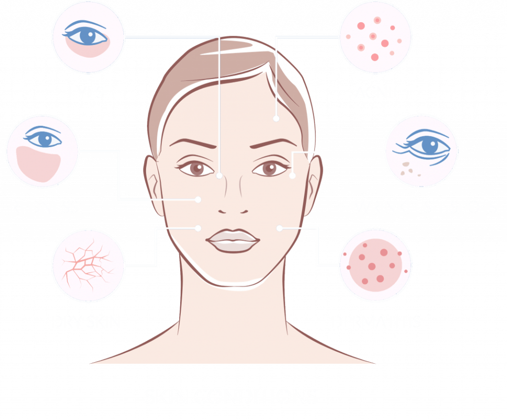 skin-conditions-min skin-conditions-min
