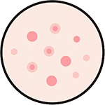 acne-prone-skin_icon_150 acne-prone-skin_icon_150