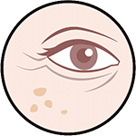 Dark spots_icon_150 Dark spots_icon_150