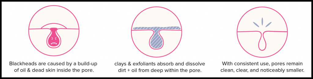 blackhead-removal-using-clay-masks-min blackhead-removal-using-clay-masks-min